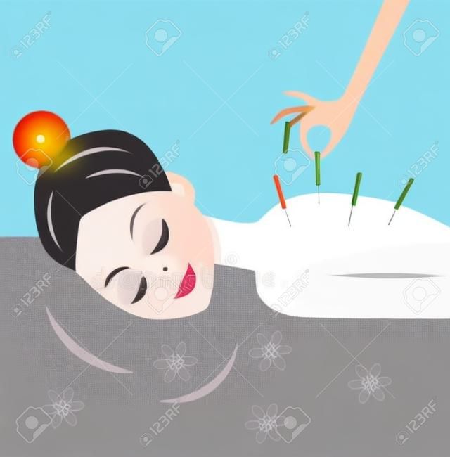 young woman accept procedure acupuncture, vector illustration