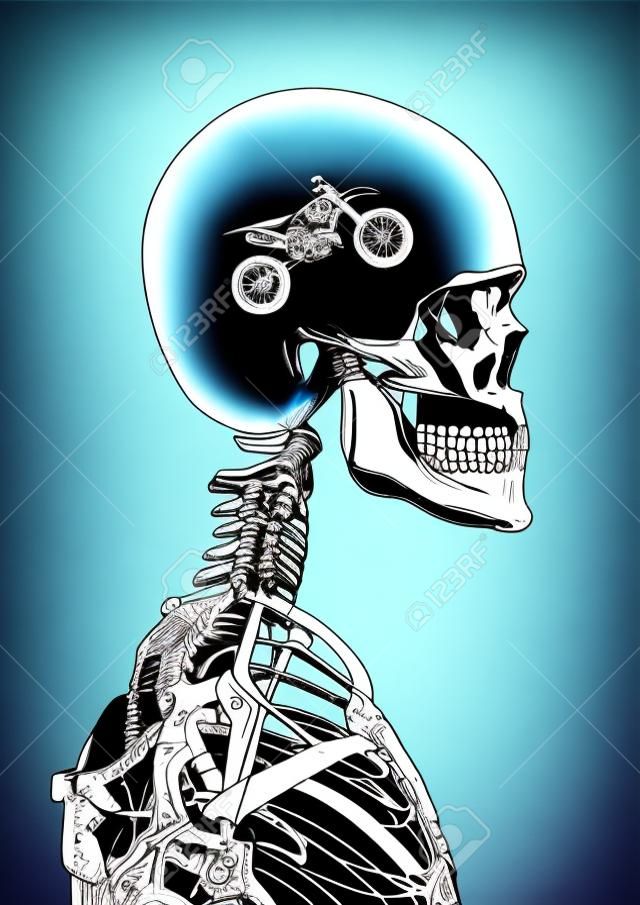 X-ray motocross fan of human skeleton x-ray showing dirt bike inside head