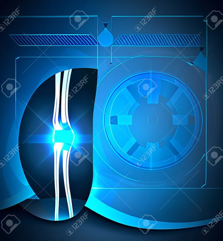 Kniegelenk blauem Hintergrund, gemeinsame Behandlungstechnologie