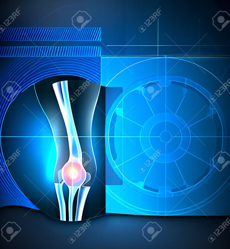 Kniegelenk blauem Hintergrund, gemeinsame Behandlungstechnologie