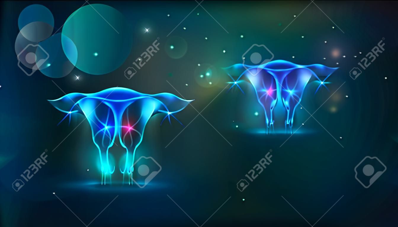 Female uterus and ovaries health abstract dark background