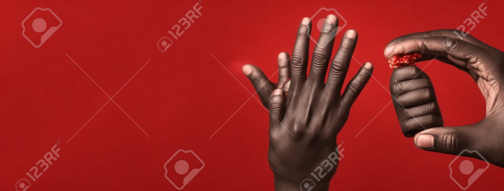 Doctors hand holding monkeypox vaccine with male hand affected by blistering rash because of monkeypox on red background.