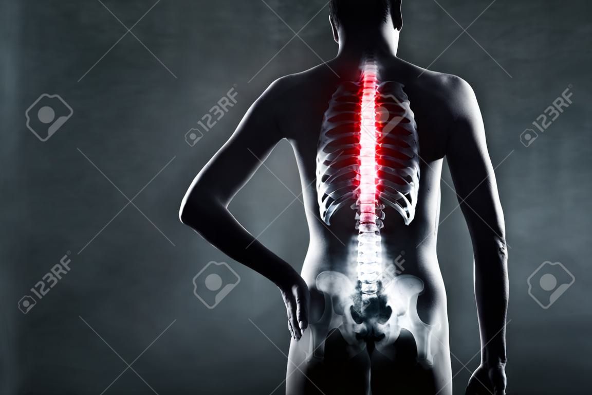 Human spine in x-ray, auf grauem Hintergrund. Die Brustwirbelsäule ist von roter Farbe hervorgehoben.