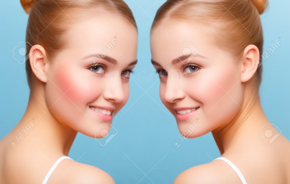 Comparison portrait of young girl with problematic skin before and after treatment