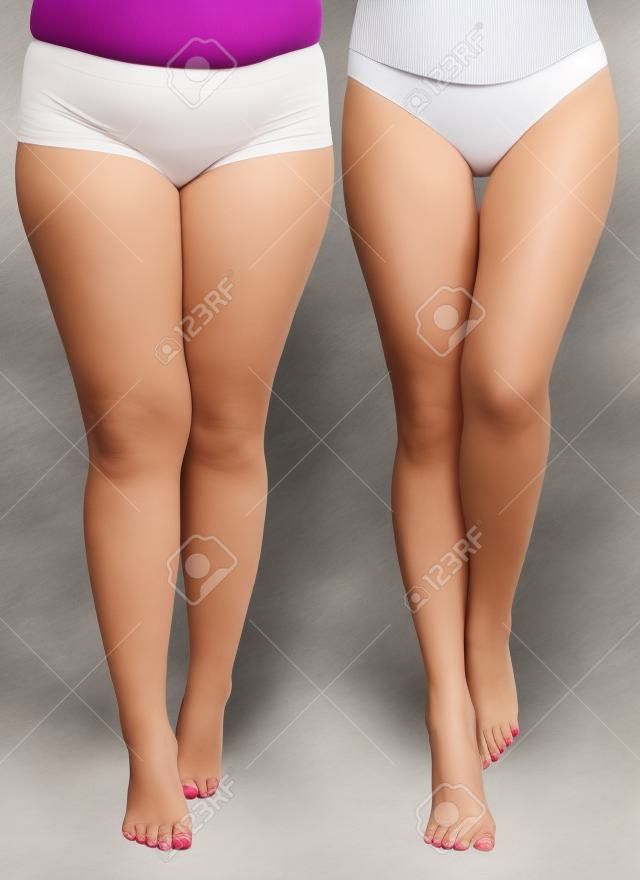 女人的腿減肥前後。