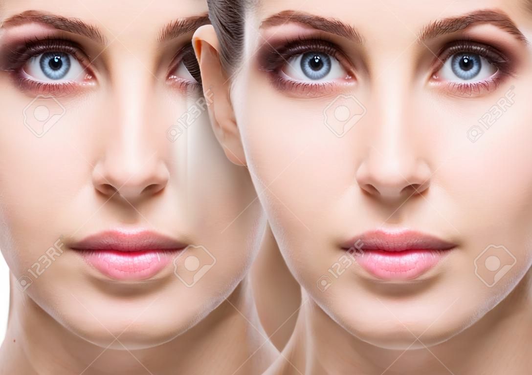 Kobiece oczy z siniakami pod oczami przed i po zabiegu kosmetycznym.