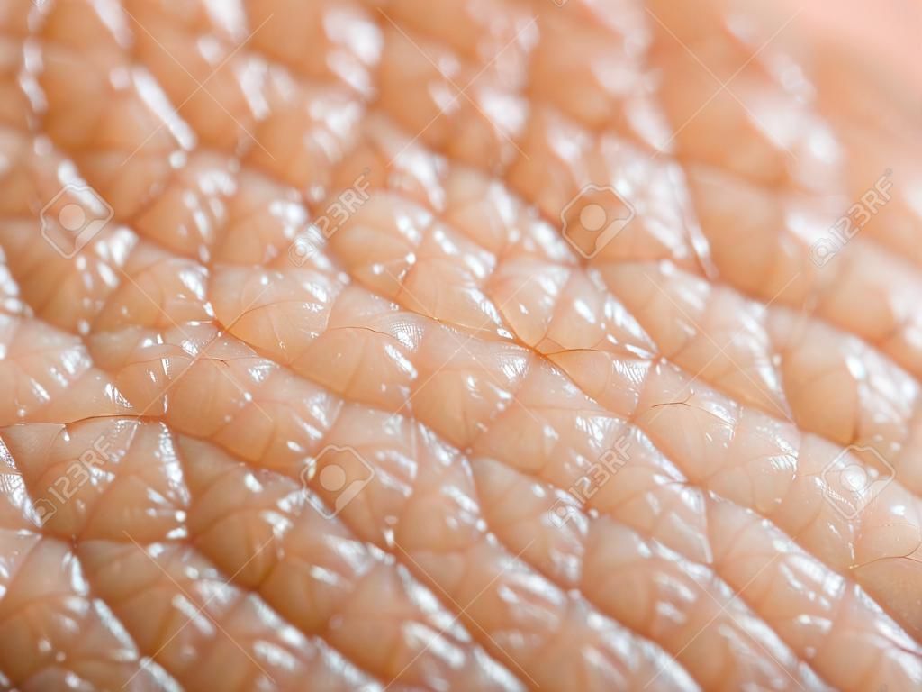 Closeup de pele humana oleosa porosa. Grandes poros na pele, fundo, macro, couro de pele de combinação