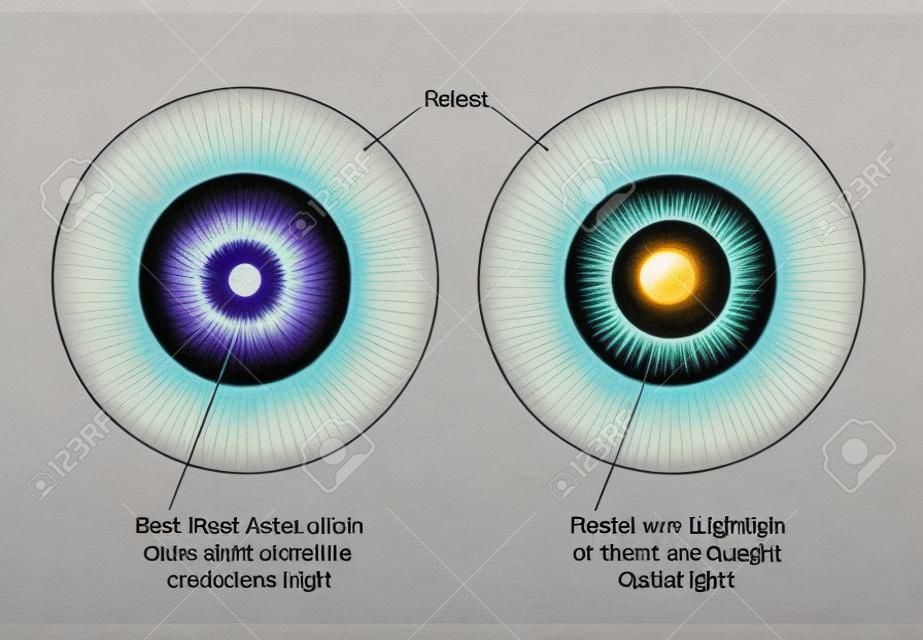 Dibujo para mostrar los músculos circulares del iris y de los músculos radiales del iris utilizados en el control de la luz en el ojo