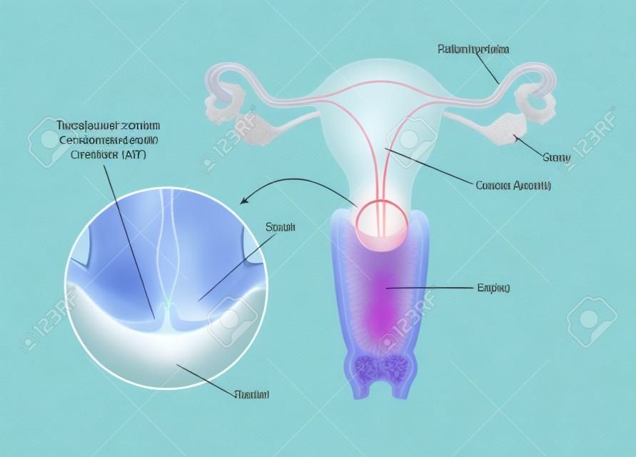 Transformationszone der Zervix