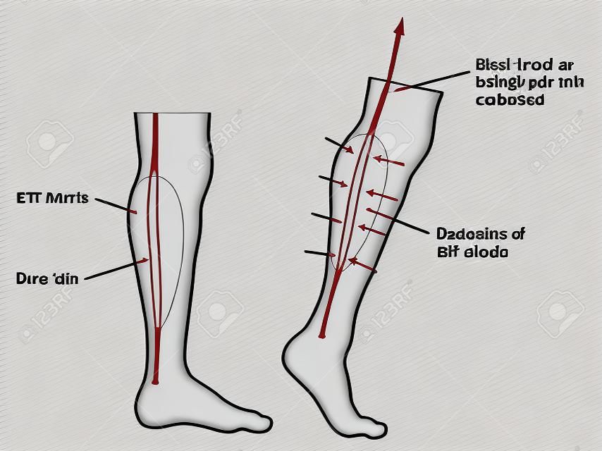 Drawing to show blood forced up from legs due to calf muscle pump. Created in Adobe Illustrator.  EPS 10.