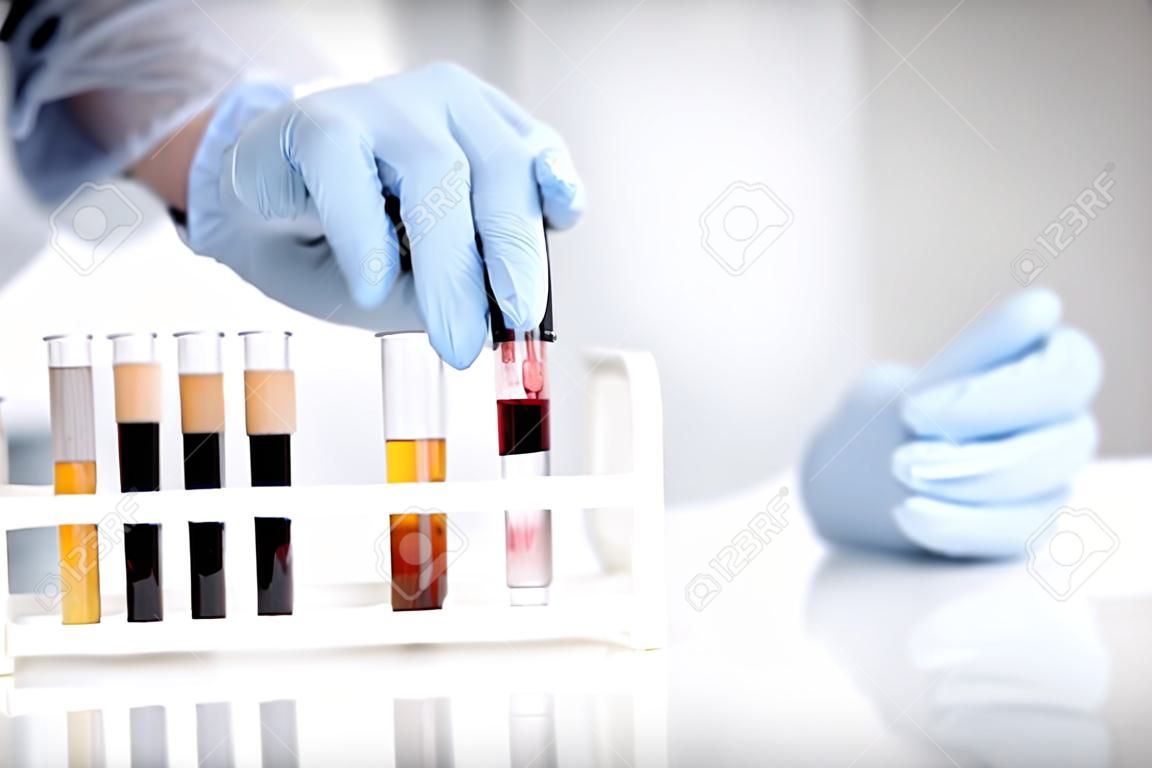 Careful medical worker wearing rubber gloves while working with blood samples in test tubes