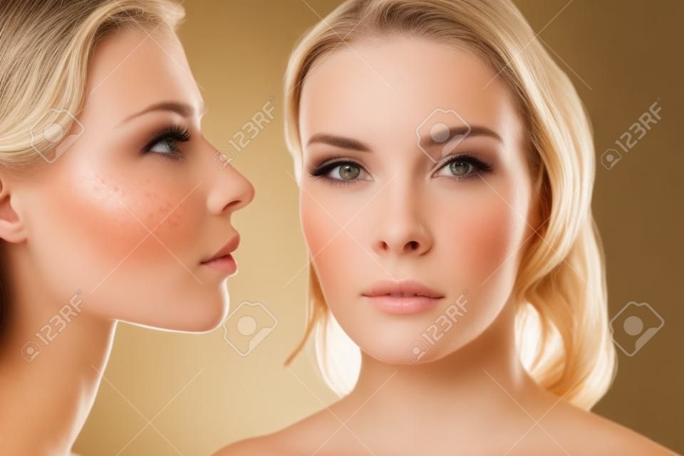 Femme brune à la peau acnéique regardant la fille blonde aux taches de rousseur tout en posant