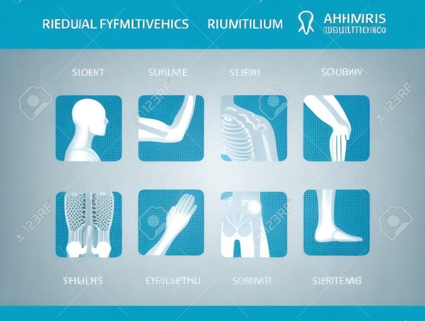 Rheumatism or rheumatic disorder medical set. Arthritis joint pain syndrome. Different body parts with pain rings on hand, leg and feet, spine, scull, pelvis. Rheumatology vector infographics elements