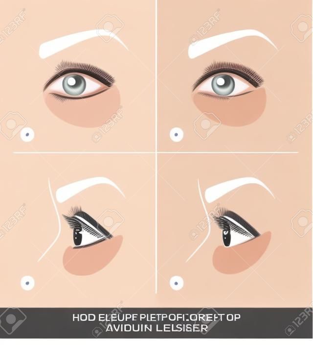 How to Apply Under Eye Patches and Protection Pads for Eyelash Extensions Properly. Hold Down Bottom Eyelashes for Eyelash Extensions. Guide. Infographic Vector Illustration