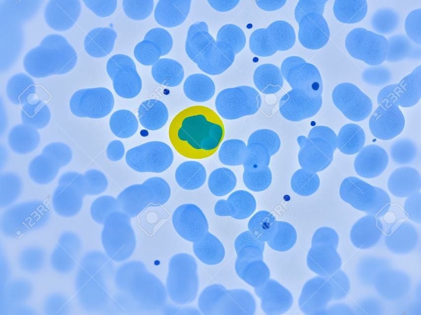 celular de neutrófilos (glóbulos blancos) en el frotis de sangre periférica