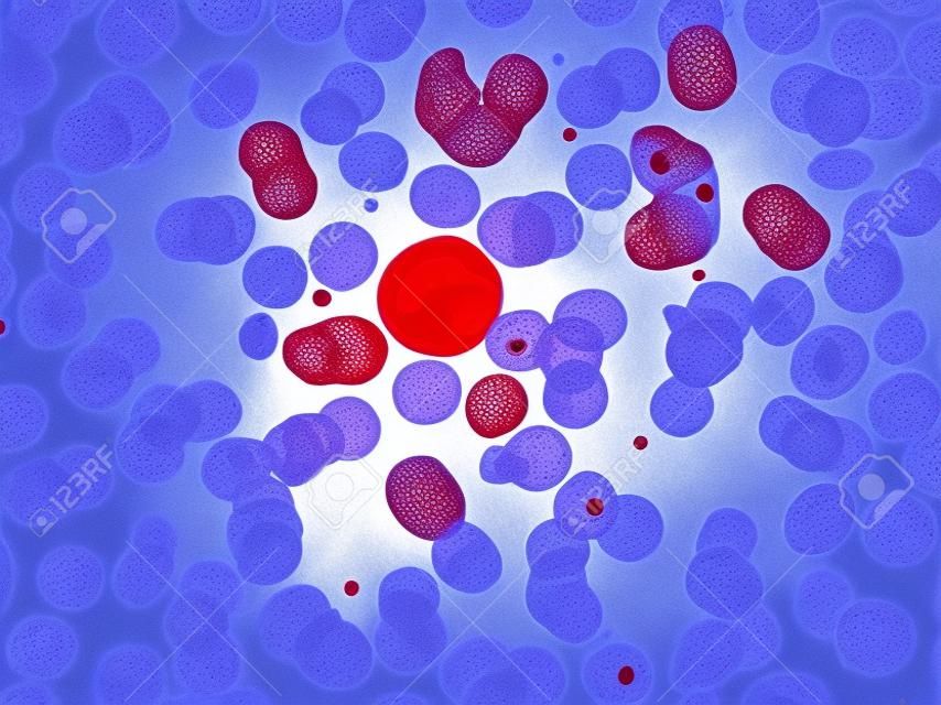 Neutrophil cell (white blood cell) in peripheral blood smear