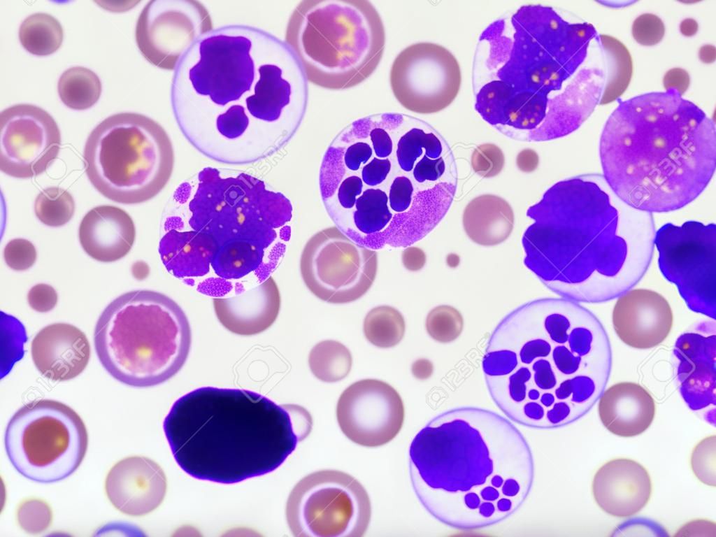 白血細胞在血液塗片