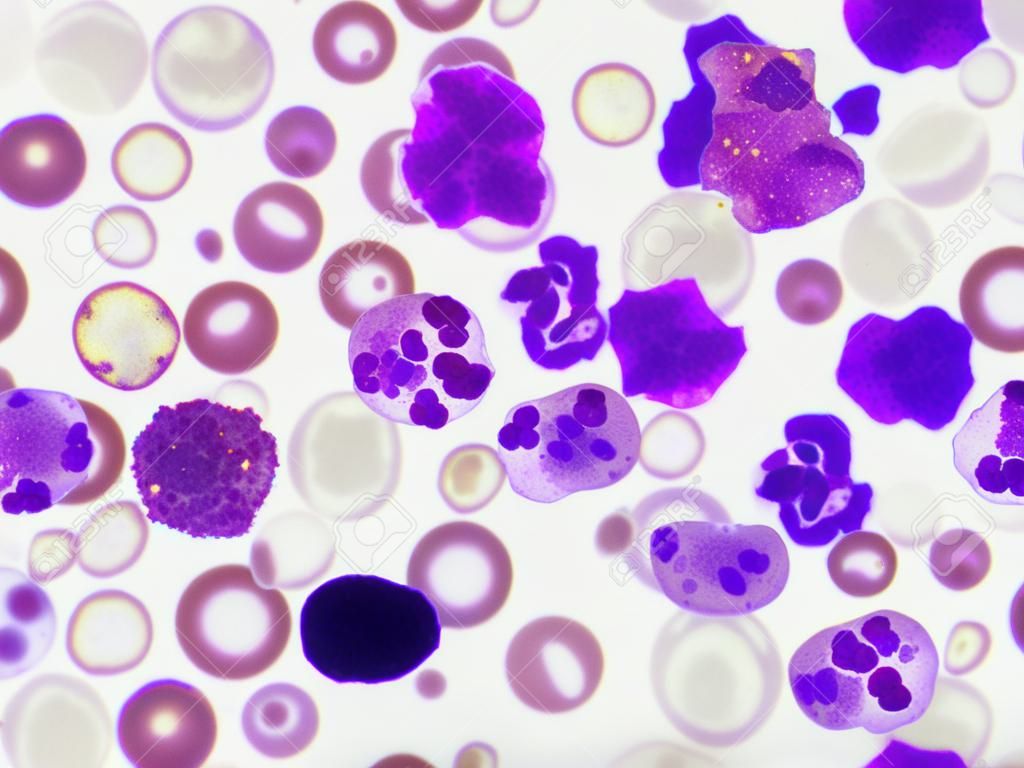 Witte bloedcellen in bloeduitstrijkjes