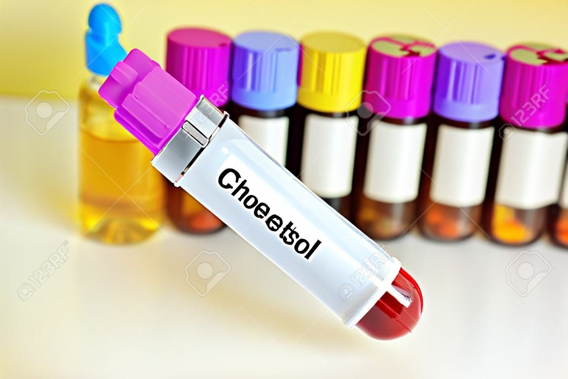 Blood sample for cholesterol test