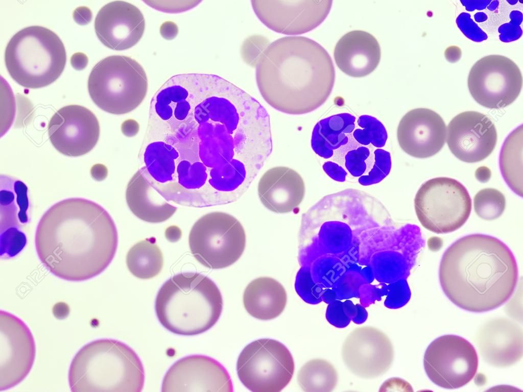 White blood cells in peripheral blood smear