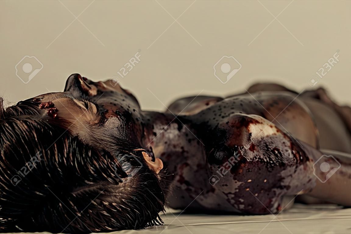 Close up Burnt Körper eines toten jungen Jungen auf dem Tisch liegen in Morgue, betonend, Kopf und Schulter.