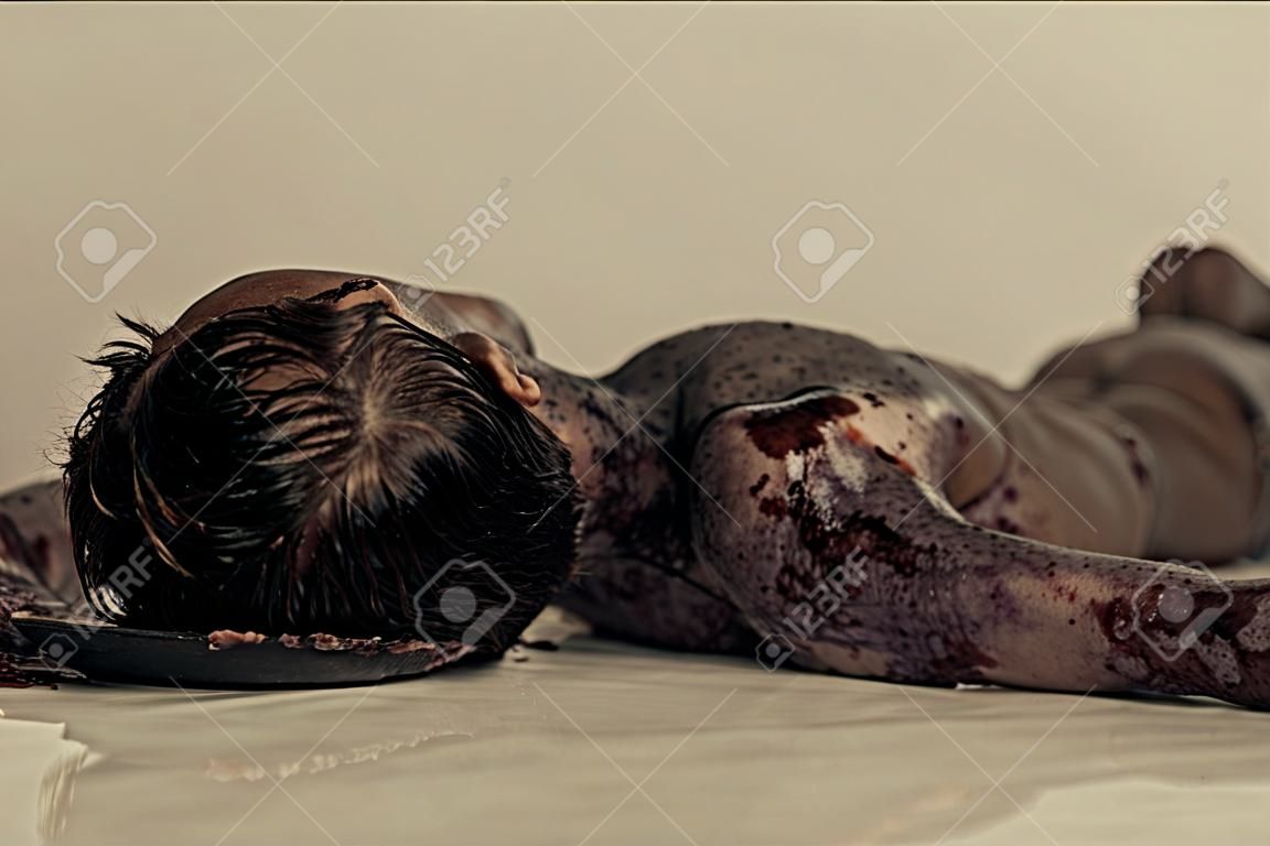 Close up Burnt Körper eines toten jungen Jungen auf dem Tisch liegen in Morgue, betonend, Kopf und Schulter.
