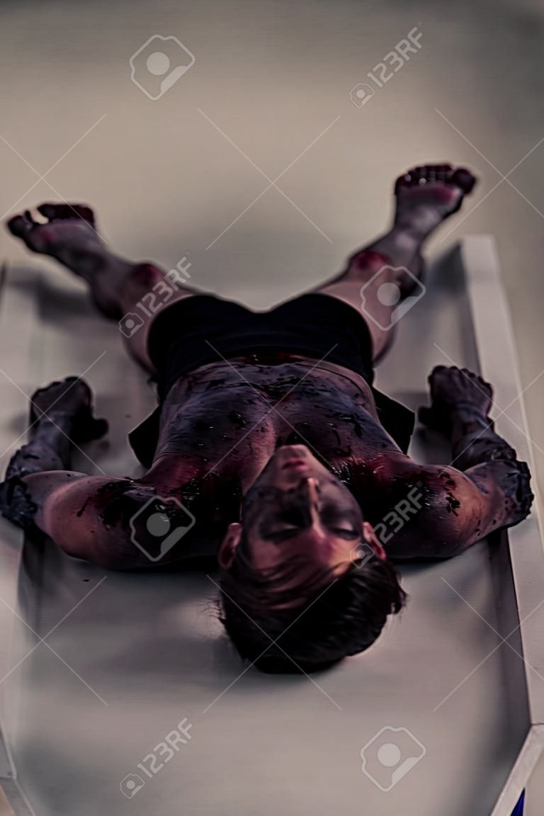 Colpo di corpo pieno di un Burnt cadavere di un giovane ragazzo che si trova sulla tabella all'interno di una Morgue