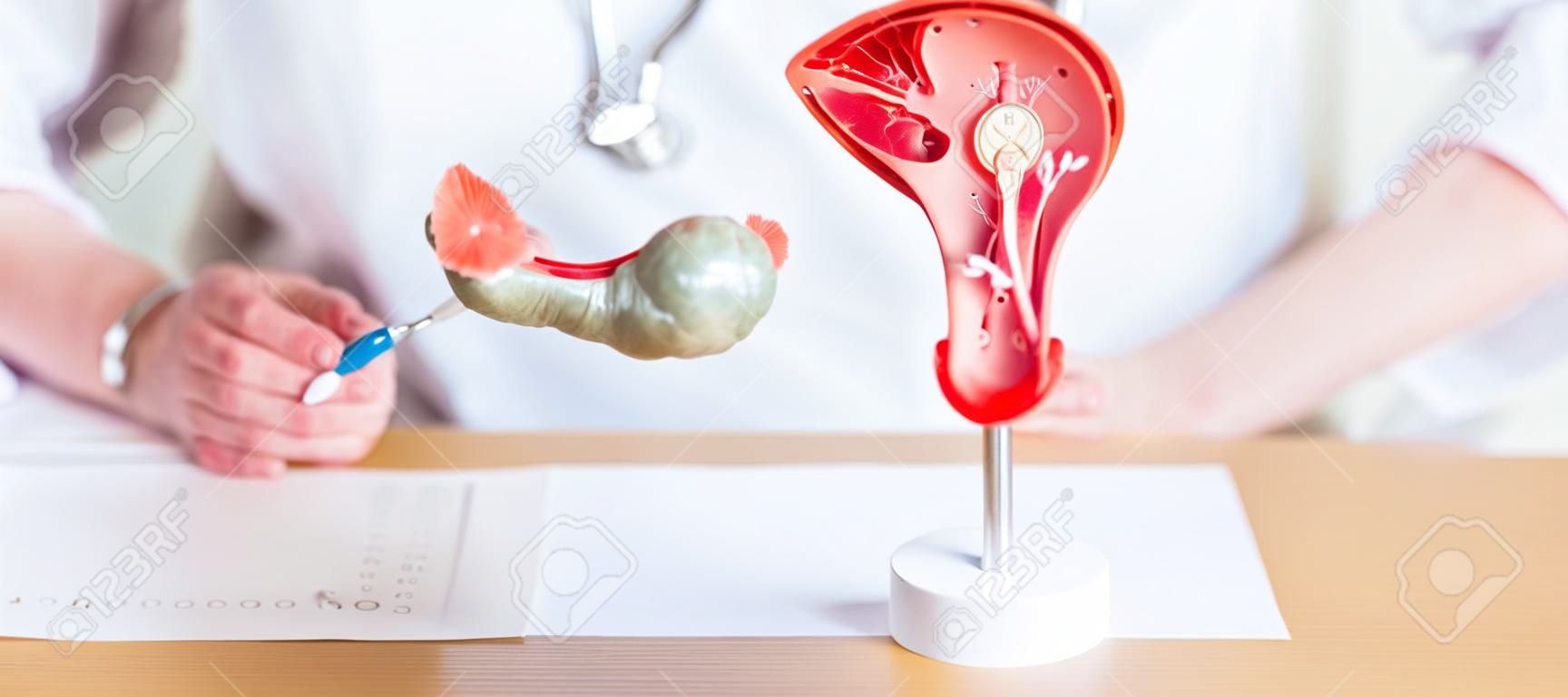 Doctor with Uterus and Ovaries anatomy model. Ovarian and Cervical cancer, Cervix disorder, Endometriosis, Hysterectomy, Uterine fibroids, Reproductive system, Pregnancy and health concept