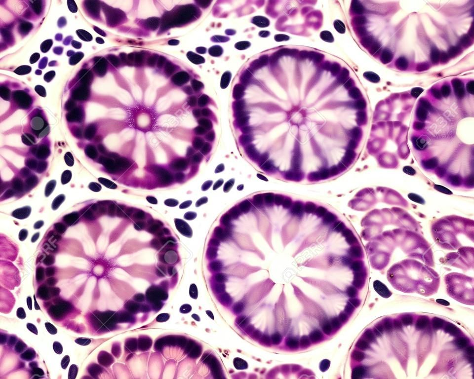 Cross section of intestinal glands (crypts of LieberkÃ¼hn) showing mucous goblet cells. Human colon.