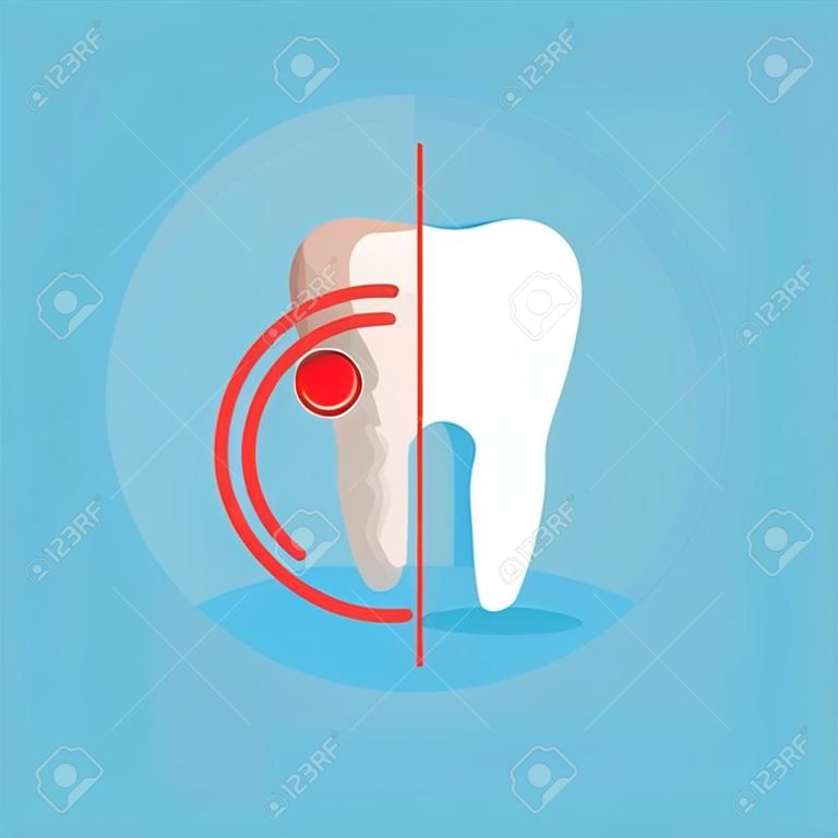 Cleaning teeth. Sick tooth. Before and after treatment. dental health concept. Vector illustration isolated on blue background.