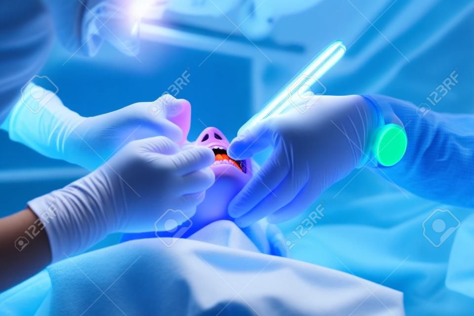 child teeth stopping treatment with dental curing ultraviolet light equipment