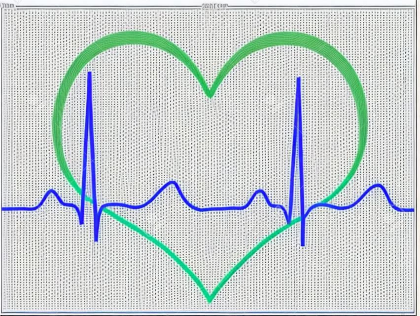 Electrocardiogram, ecg, graph, pulse tracing