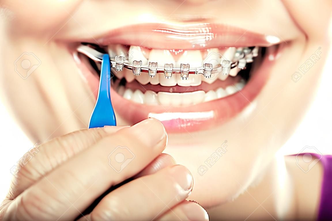 흰색 배경에 치아를 칫솔질 치아 고정 장치와 함께 아름 다운 웃는 소녀.