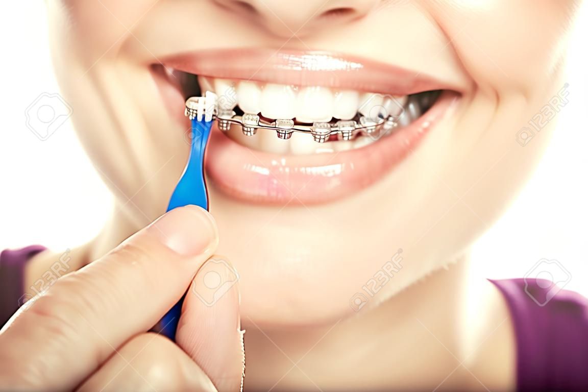 Bella joven sonriente con retenedor para los dientes cepillarse los dientes sobre un fondo blanco.