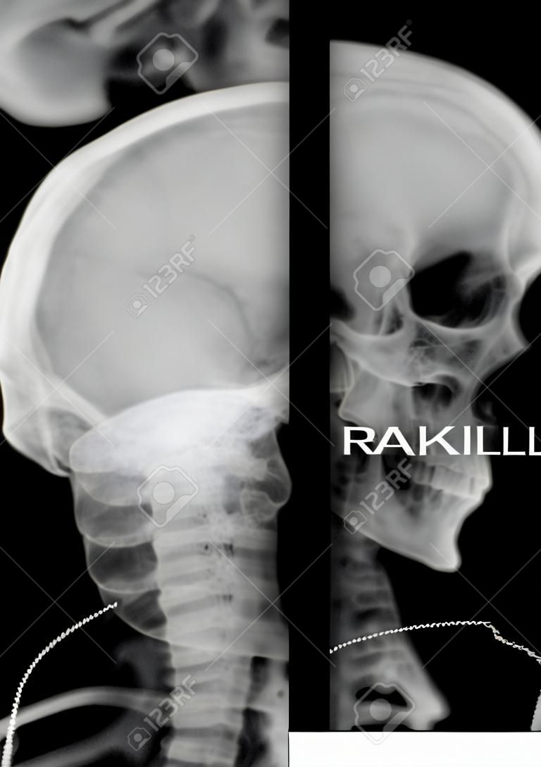 radiographs skull and cervical vertebrae