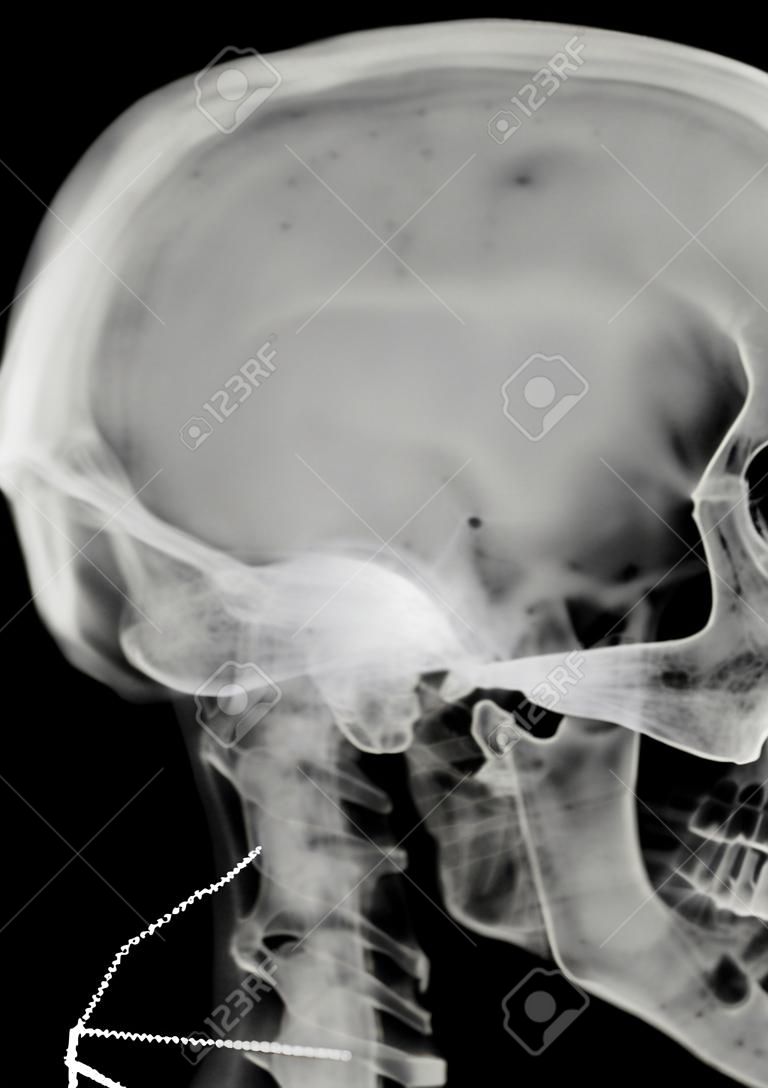 radiographs skull and cervical vertebrae