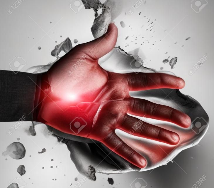 人的手受伤从事故和血液出血在白色背景，保险概念上的伤口