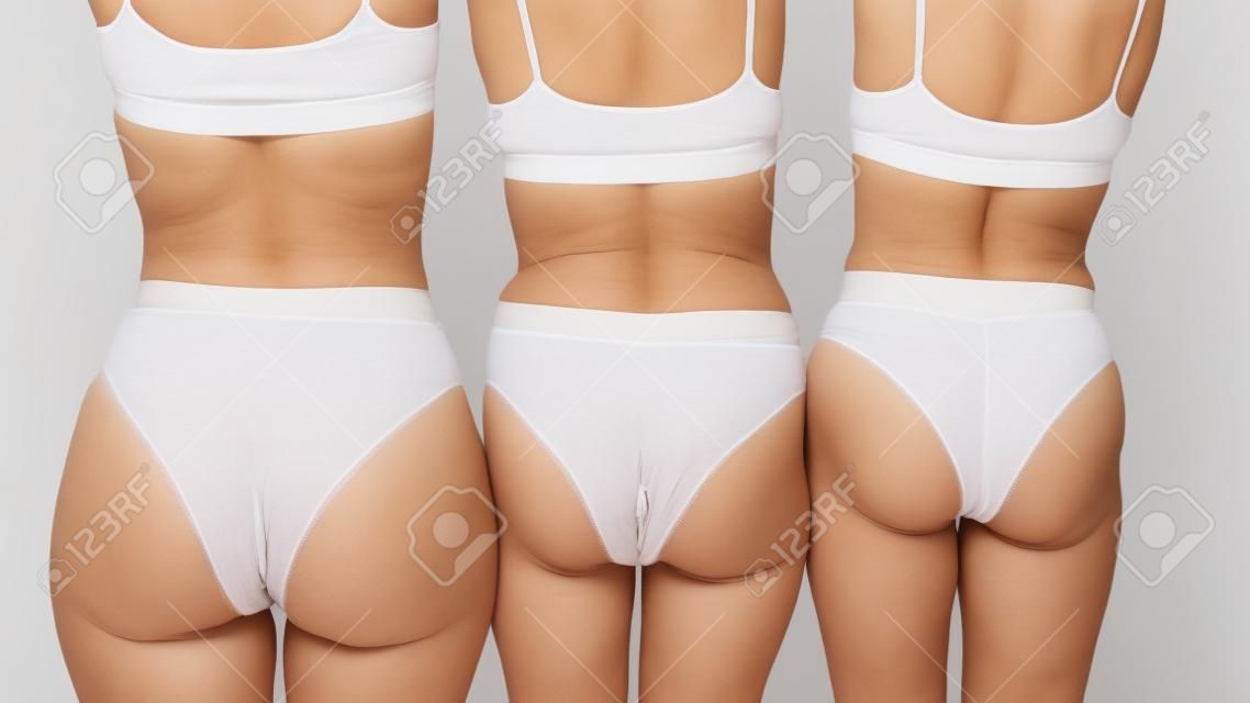 Reife Frauen mit faltiger Haut am Hintern