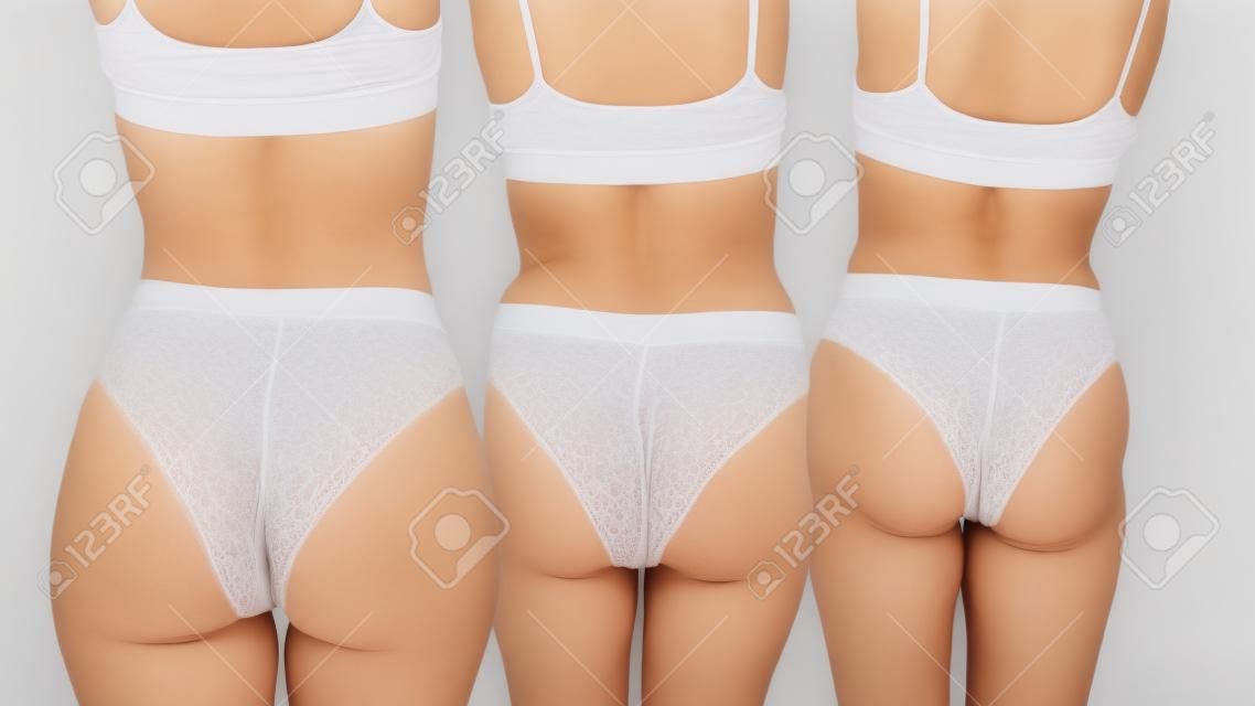 Mature women with wrinkled skin on their butts