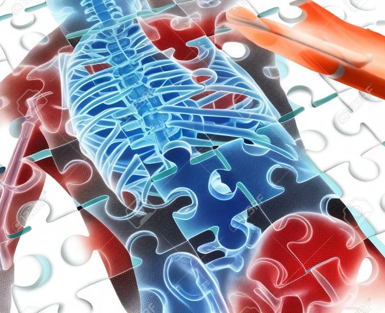 Nuevo concepto de enfermedad médica Humana, con una textura rompecabezas y falta una pieza como la anatomía esqueleto roto y un símbolo de la columna vertebral y dolor en las articulaciones causado por la inflamación