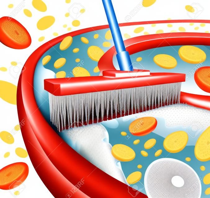 Cleaning arteries concept as a broom removing plaque buildup in a clogged artery as a symbol of  atherosclerosis disease medical treatment opening clogged veins with blood cells as a metaphor for removing cholesterol as an icon of vascular diseases 