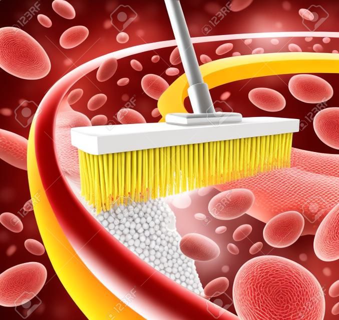Nettoyage artères concept comme un balai enlever l'accumulation de plaque dans une artère bouchée comme un symbole de la maladie de l'athérosclérose ouverture de traitement médical veines obstruées avec des cellules de sang comme une métaphore pour éliminer le cholestérol comme une icône de maladies vasculaires