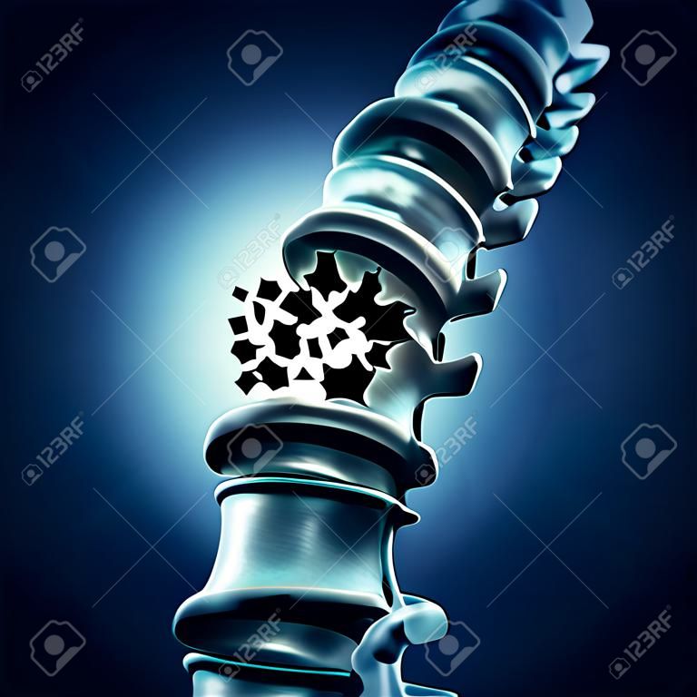 Frattura della colonna vertebrale e trauma cranico vertebrale concetto medico come colonna vertebrale di anatomia umana con una rottura di una vertebra scoppiata a causa di compressione o di altre malattie della schiena osteoporosi.