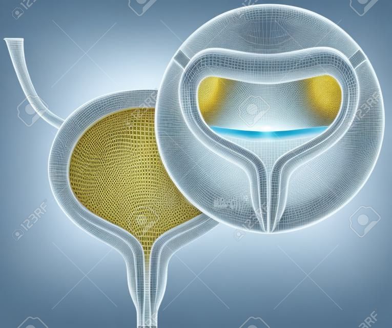 Overactieve blaas en onvrijwillig urineverlies concept als een ongemakkelijke toestand in een menselijk orgaan met 3D-illustratie-elementen.