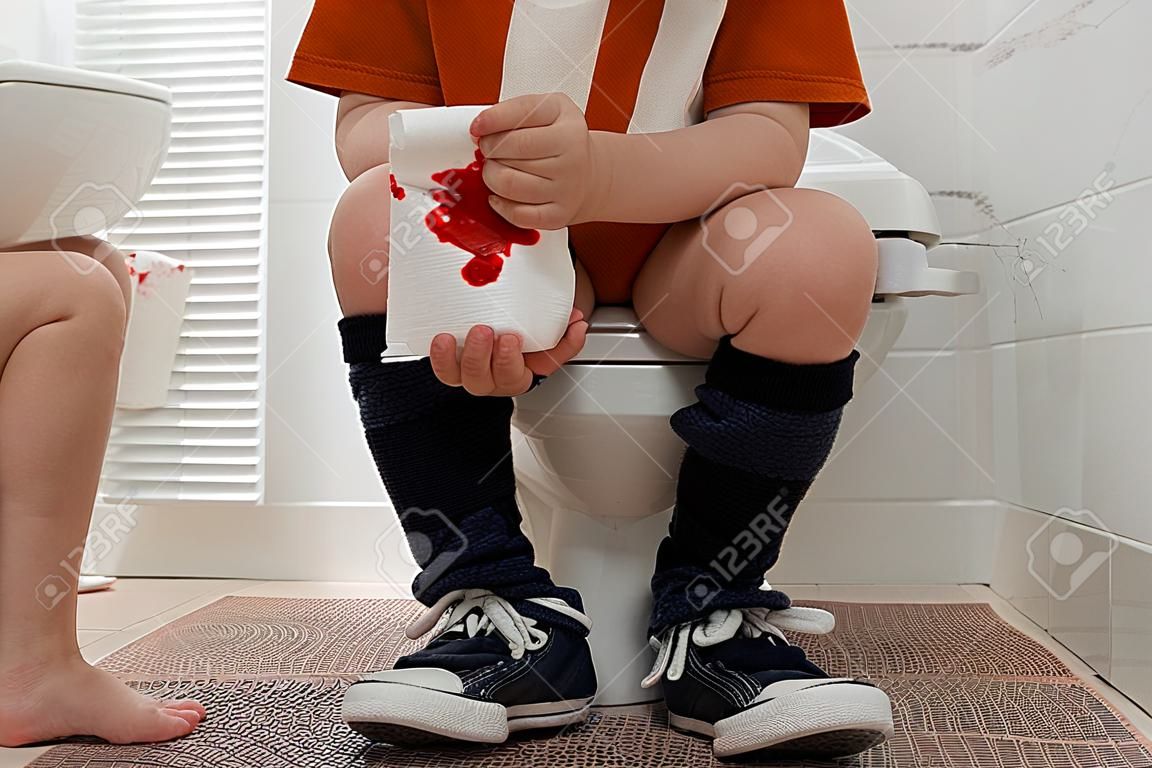 Boy holding toilet paper with blood stain in rest room, closeup. Hemorrhoid concept