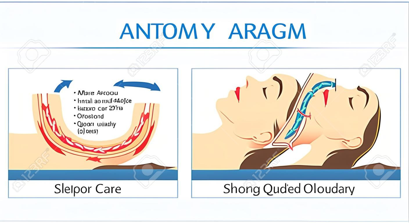 Anatomie der Frau während normalen Schlaf und haben Schnarchen. Illustration über das Gesundheitswesen und die medizinische
