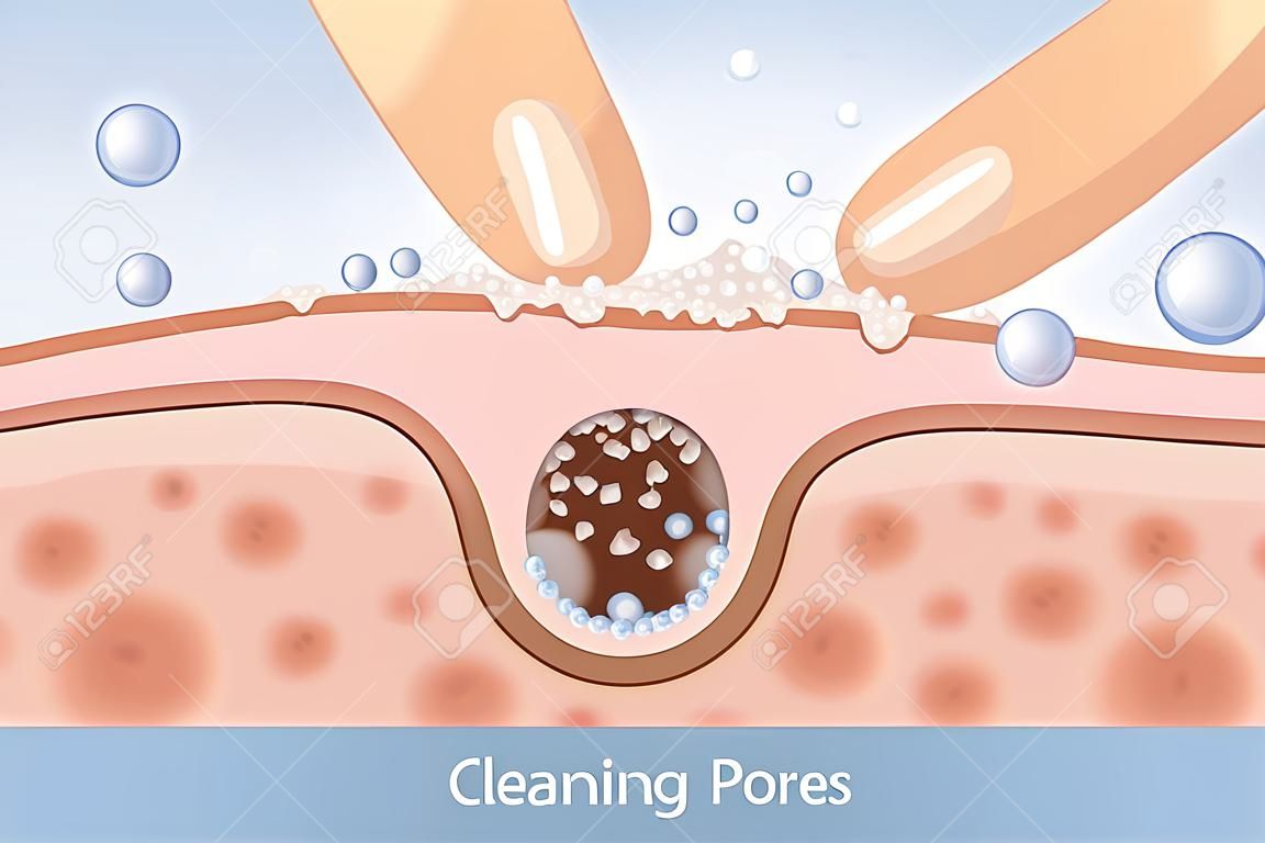 Nettoyage désobstruer les pores avec la main. Cette illustration sur les soins de la peau et la beauté.