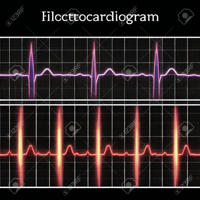 Normale und tachykarde EKG-Charts, 2d medizinische Vektor-Illustration auf dunklen Gitter Hintergrund