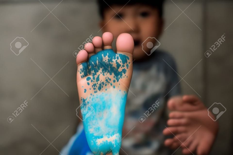 Asian boy showing dirty feet.
