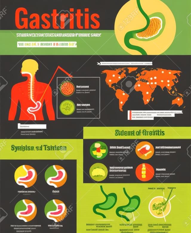 Gastritis symptoms stomach ulcer causes information on unhealthy food habits world population affected infographic poster  illustration